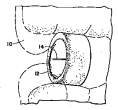 Patent9a.gif