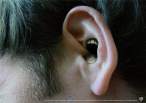 Ear bite.jpg