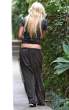 sophie_monk_bruised_hips_3.jpg