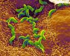 Helicobacter Pylori 4.jpg